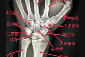 学习《X线读片指南》骨、关节系统——腕关节图片
