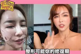 辣模整形15次花费上百万，公开手术录像太痛苦，被骂反怼：酸民图片