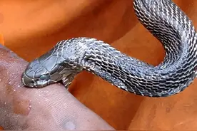 美国男子为了让自己身体免疫蛇毒，17年间被200种毒蛇咬了200次图片