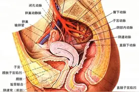 当女人膀胱、宫颈、直肠被癌症强行“打通”以后会是什么后果？图片