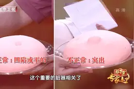 肚脐长这样，可能暗示肝脏出了问题！辨清四个迷惑性症状图片