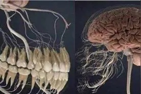 拔牙之后疼的受不了？要警惕干槽症了，真的要重视起来抓紧复诊图片