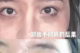 闷逗、长闭口？那是你的卸妆油用错了，油敏肌的卸妆挚爱好物图片