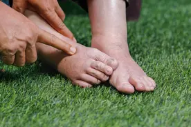 老年人小腿和脚背浮肿是怎么回事？警惕4种原因，教你改善绝招图片