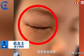 这题“辣眼睛”！小女孩一做数学就眼睛过敏 妈妈：其他科作业都没事……图片