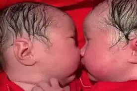 刚出生的龙凤胎就一直亲，护士都分不开，画面实在太暖心了图片