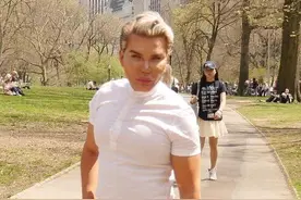 巴西男花百万全身整容！从腹肌到牙齿全是假体，脸丑却靠衣品出名图片