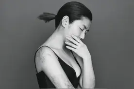 被烧伤毁容十年，38岁的Selina变得更美：“别再劝我坚强……”图片