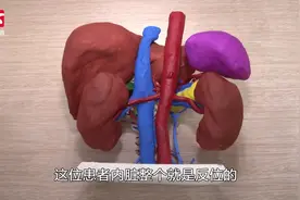 活了53年才知体内器官全长反！医生：百万里挑一的“镜面人”视频封面