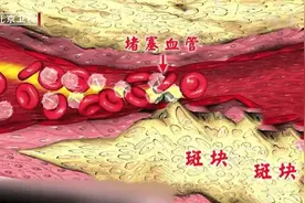 大豆是调理血脂的“高手”，但吃错了血脂可能更高！帮你认清豆制品的“真面目”图片