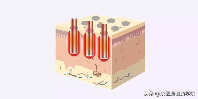 胶原蛋白粉是什么做的 2026年胶原蛋白粉是干什么用的