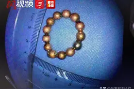 警惕！4岁陕西男童误吞13颗磁力珠 被取出时已粘连胃壁图片