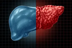 症状提醒：乙肝恶化的信号有哪些图片