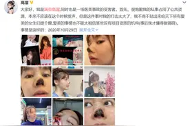 女演员整容鼻尖坏死，“容貌焦虑”怎么破？图片