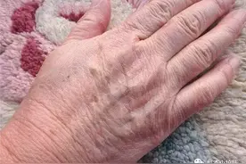 手部粗糙难看怎么办？教你一招嫩白法，立马就能白嫩光滑又细腻图片