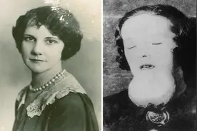 镭女孩：为了制造夜光手表，她们下颌骨被射线无情摧残图片