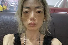 甜美名模22岁嫁入豪门，8年瘦到只有44斤，最后被扫地出门图片