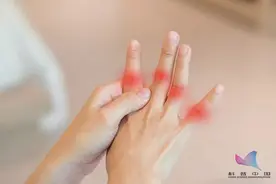 手指变粗、指甲变形，一查竟是癌症！这些"异样"需要警惕图片