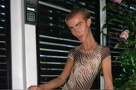 英国男星莫名暴瘦自称一切正常，网友们不淡定了：这瘦得诡异啊图片