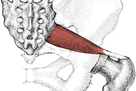 说说梨状肌综合征图片