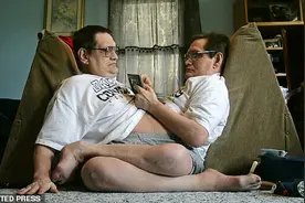 最长寿“连体双胞胎”去世，终年68岁，三岁起就在嘉年华中表演图片