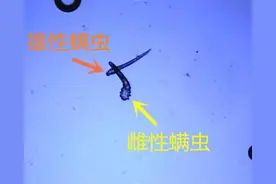 三根睫毛寄生17条螨虫，撸猫的你要当心图片