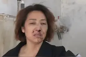 母亲不洗手强行抱孙子竟被儿子打断鼻梁，儿媳却说是婆婆说话太过图片