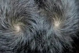 孩子头上的“旋”代表什么？与智商和性格有关吗？今天来告诉你图片