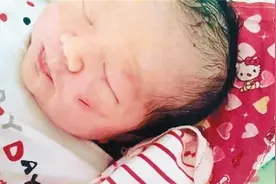 预防抓脸给娃戴防挠手套？这些“危害”比抓伤脸严重，爸妈别忽视图片