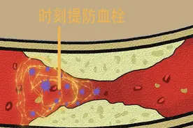 体内有没有血栓，看看“手指”就知道，若手指有3症状，及时检查图片