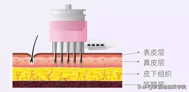 胶原蛋白粉是什么做的 2026年胶原蛋白粉是干什么用的