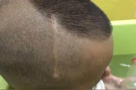 玻璃破损，两岁男孩从商城三米高楼道摔下，家长和商城陷入赔偿纠纷，责任谁来负？图片