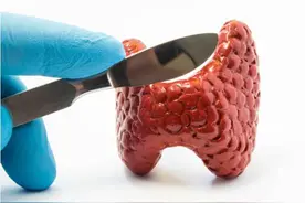 甲状腺结节发生恶变时，身体会出现4种异常，需留心观察图片