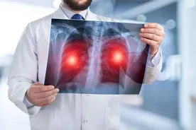 40岁之后，身体若出现4种明显“变化”，最好查一下肺CT图片