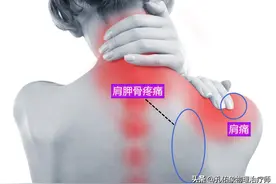后背、肩胛骨区域疼痛、紧张或僵硬，是怎么回事？一文详细告知您图片