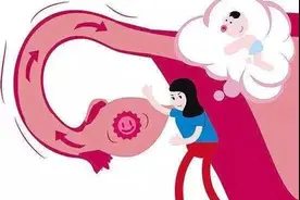 输卵管积水了，还能自然怀孕吗？图片