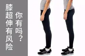 什么是膝超伸？很多人都有，但不知道其危害，医生告诉你如何预防图片