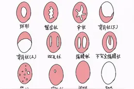 处女的第一次一定会出血？这层膜到底有啥用？别被男人“洗脑”了图片