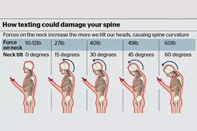 老是驼背?来试试保持挺胸小技巧图片