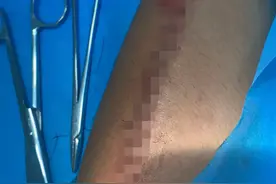 山东90后司机在广东“超载”，被迫无奈割腕求复磅！再测结果显示：未超载图片