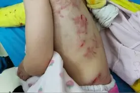 揪心！4岁女童遭黄狗撕咬约3分钟，狗的主人暂未找到图片