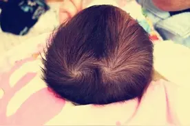 为啥有的孩子头顶一个“旋儿”，有的则好几个？原因家长要了解图片