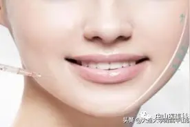 【爱美•科普】瘦脸针，让你大脸变小脸图片