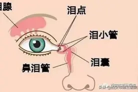 【微创治疗】两眼“泪汪汪”，耳鼻喉科把忙帮图片