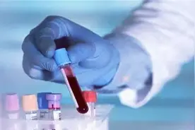 熊猫血的女性，怀二胎要当心图片