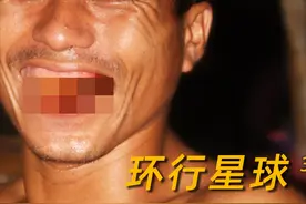 缅甸男人，为什么满嘴流血图片