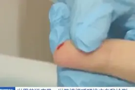 个人用唾液或指尖采血可了解艾滋病感染状况，20分钟内可出结果