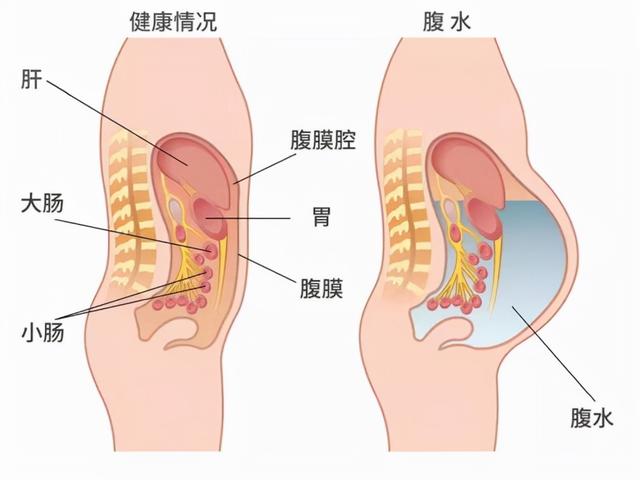取卵后喝板栗花胶乌鸡汤吗 取卵后喝板栗花胶乌鸡汤吗有影响吗