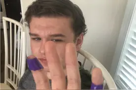 16岁少年遭鲨鱼袭击，被父亲狂揍鲨鱼鼻子救下，留下40多个牙印图片