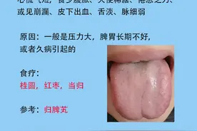 女人常见6种症状，以及对应舌象和解决的方法分享图片